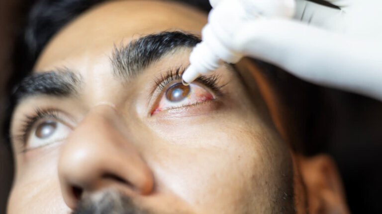 World Glaucoma Day: How Lifestyle And Nutrition Can Help Eye Health